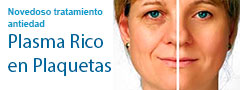 Novedoso tratameinto antiedad con PRP