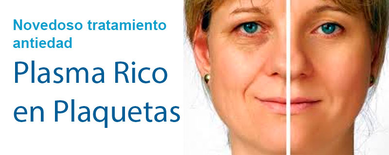 Novedoso tratameinto antiedad con PRP